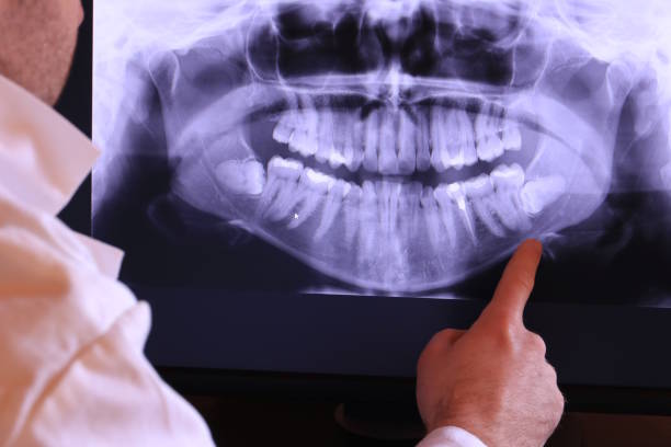Best After-Hours Emergency Dentist in Minden, NE