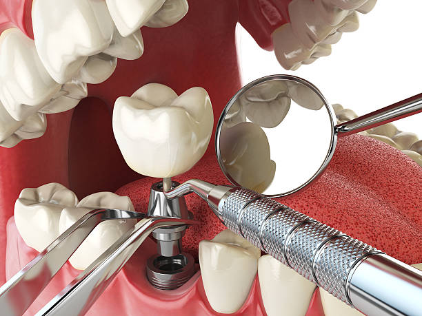 Best Emergency Dental Care for Trauma or Injury in Minden, NE